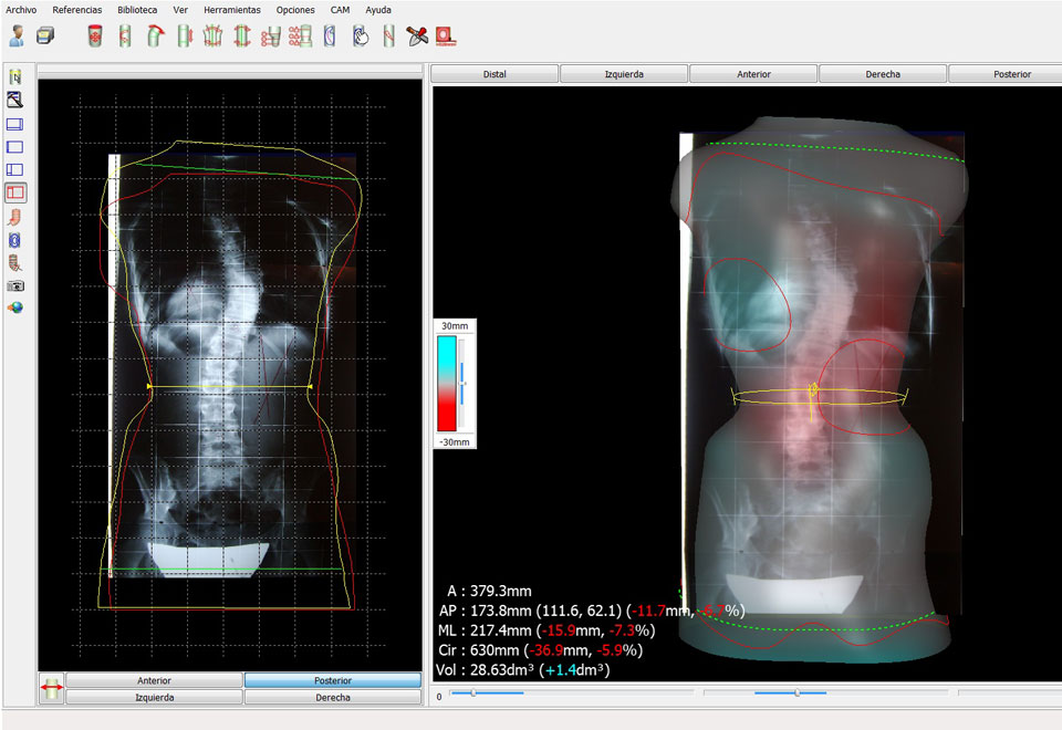 Tecnología CAD-CAM para diseño y fabricación de corses